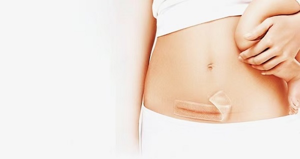 मोटी सिलिकॉन जेल स्कार शीट इतनी लोकप्रिय क्यों हैं?