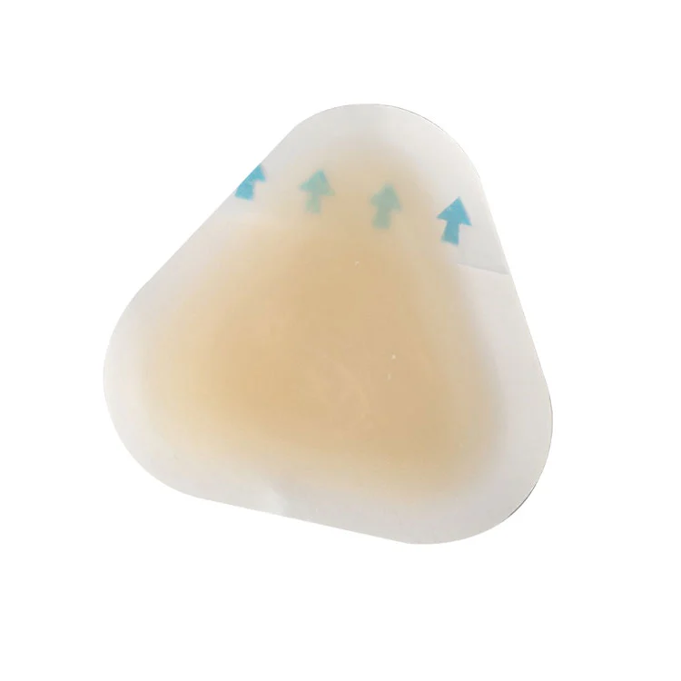 एड़ी के लिए बाँझ छाले की रोकथाम: आप अपने पैरों को दर्द, संक्रमण और घर्षण क्षति से कैसे बचा सकते हैं