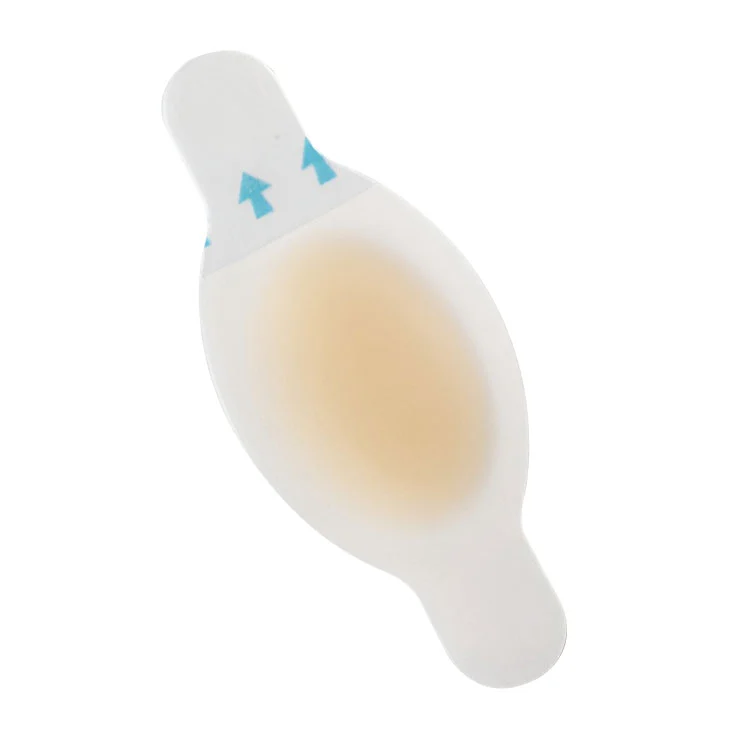 पैरों में छाले की रोकथाम के लिए जल प्रतिरोधी हाइड्रोकोलॉइड पट्टियाँ